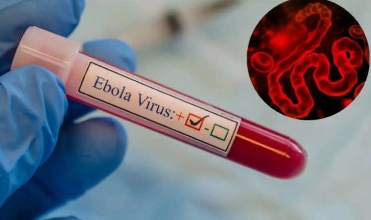 Epidemiyaya qarşı peyvəndin hazırlanması ləngiyir
