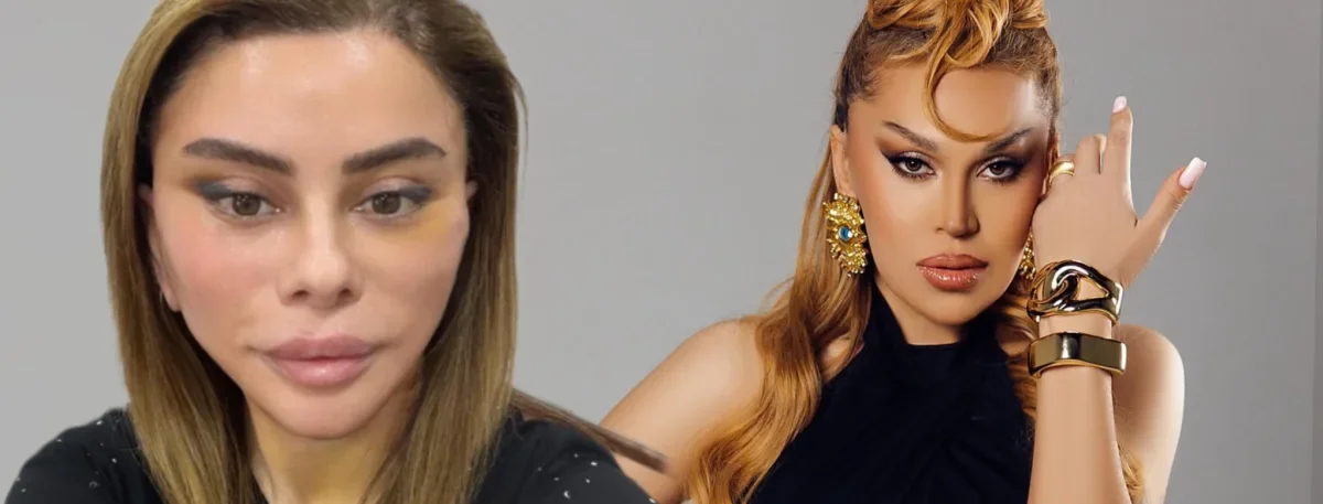 Müğənni ilə vizajist plastik əməliyyat etdirib